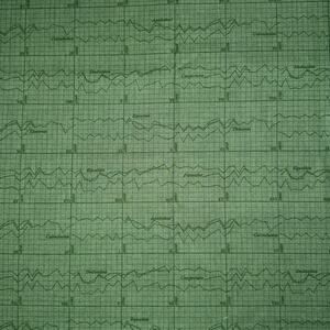 Color Theory Graph in Dark Green by Andover Fabrics - 1/2 Yard - Dark Plots